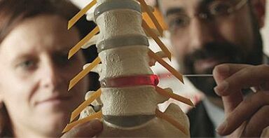 Esame dell'osteocondrosi su un modello della colonna vertebrale