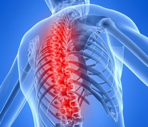 Osteocondrosi della regione lombare