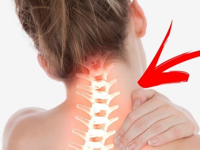 Compressione delle radici nervose con osteocondosi cervicale