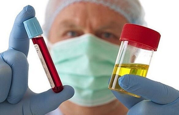 Opportunità per diagnosticare l'osteocondosi della colonna cervicale