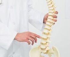 osteocondrosi lombare